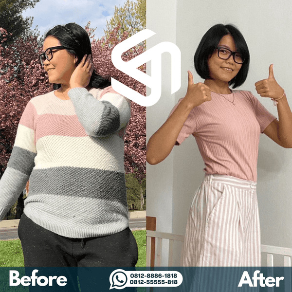 GGL Premium - Before After - Wenny